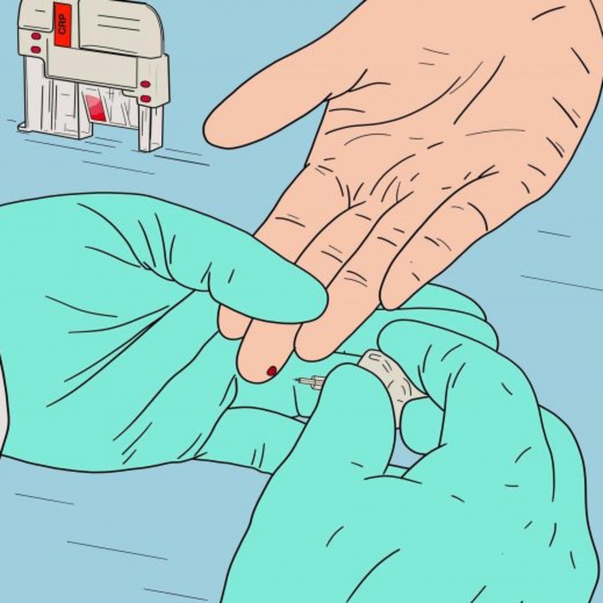 CRP- Entzündungswert bestimmen lassen bei Dr. Noyer