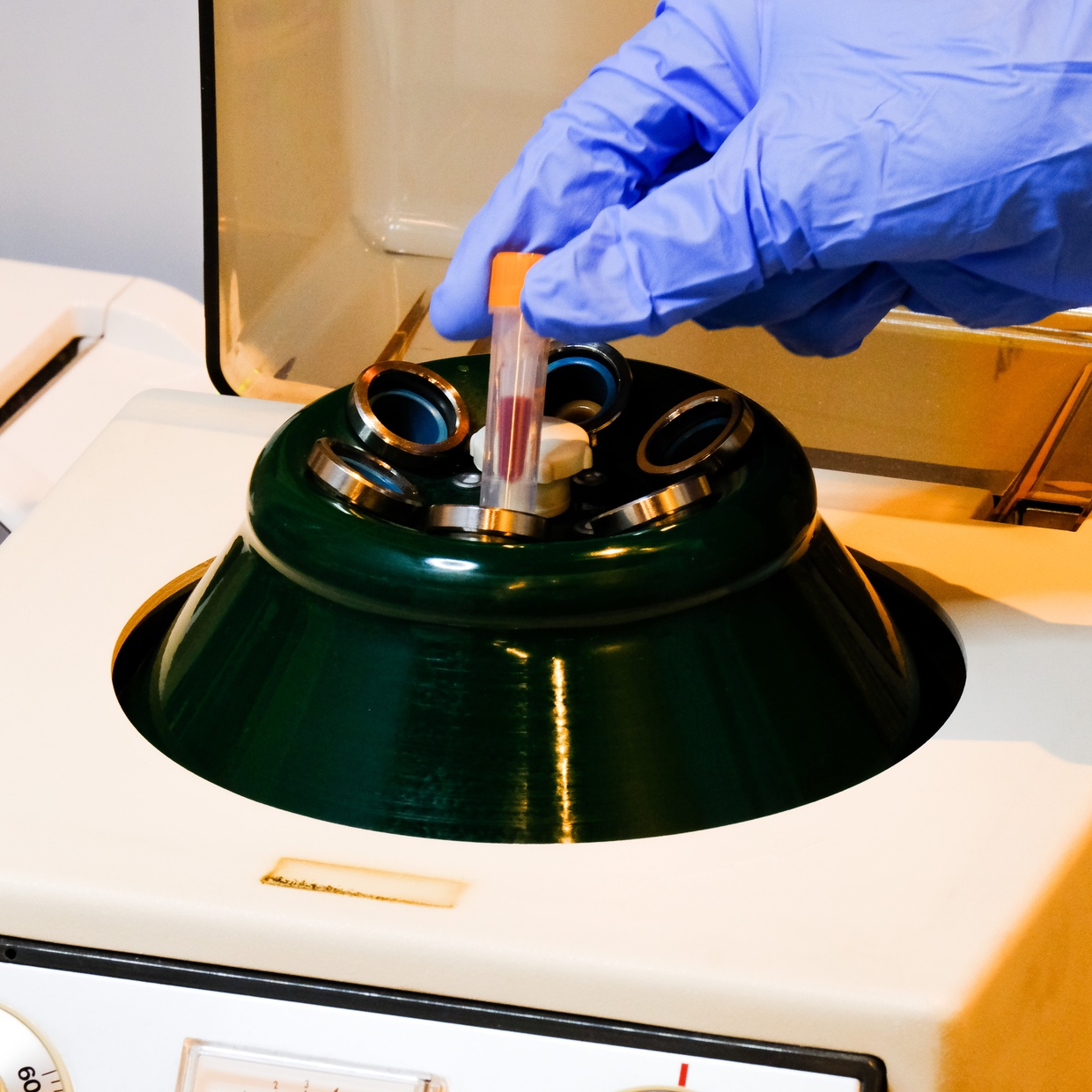 Ferritin Analyse an der Neuengasse